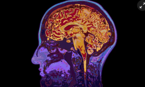 PUBLISHED: Rebecca Jordan-Young Publishes on Current Debates Around Sex and Neuroscience in The Guardian